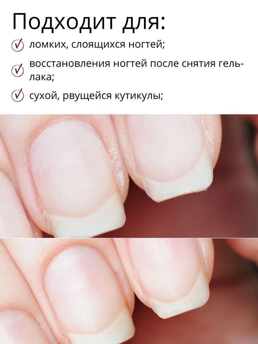 MILV Dry Nail Oil “Molecule” – 50ml Strengthening Cuticle Oil with Shimmer | NailProUSA