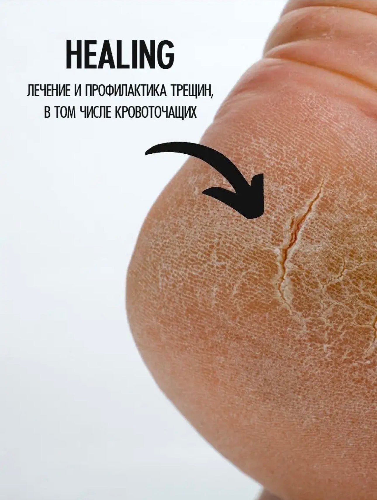 Smart Multi Paste – 150ml Healing Nail & Foot Care Balm | NailProUSA