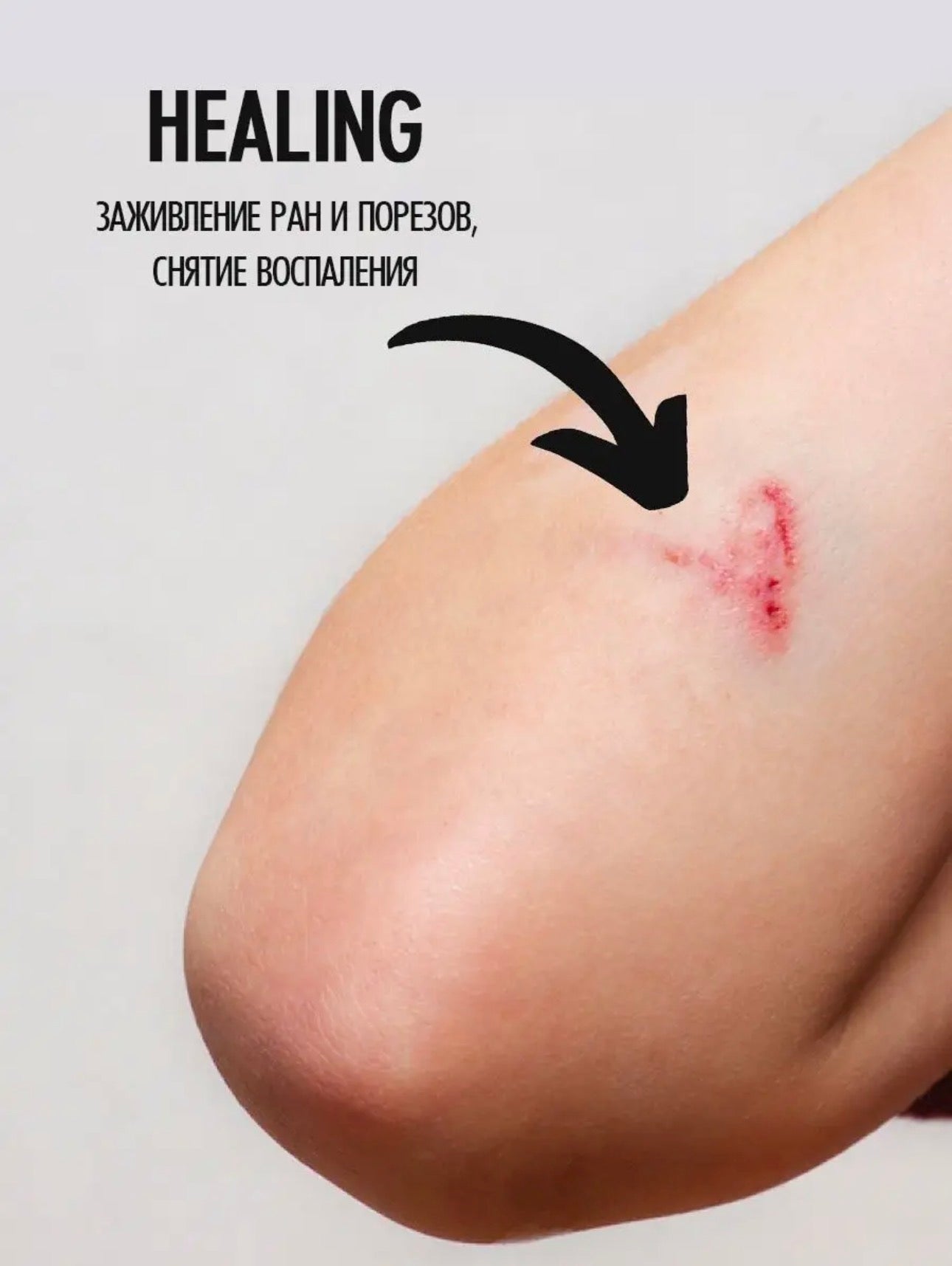 Smart Multi Paste – 150ml Healing Nail & Foot Care Balm | NailProUSA