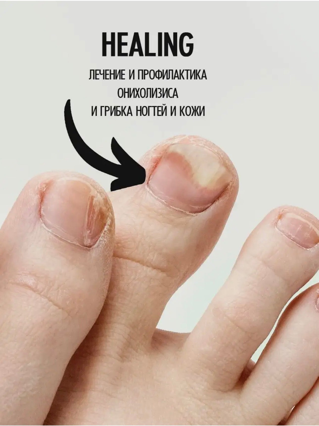 Smart Multi Paste – 150ml Healing Nail & Foot Care Balm | NailProUSA